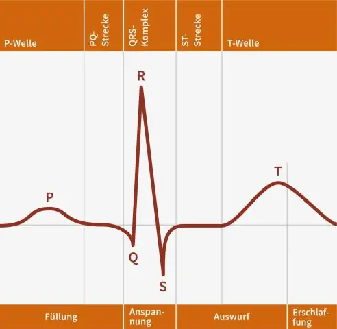 Apa yang dimaksud dengan gelombang S pada EKG?