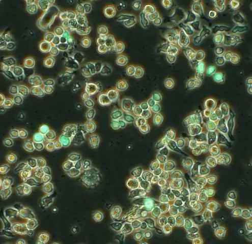 Wat wordt gevonden in eukaryote cellen maar niet in prokaryotische cellen?