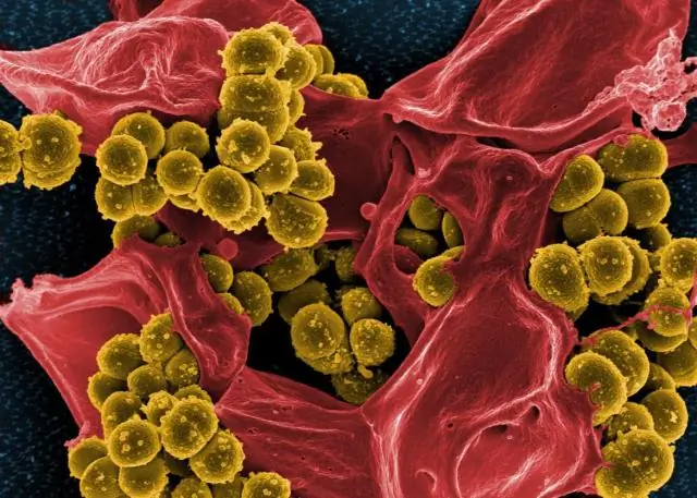 Quels niveaux de grossissement peuvent être atteints par les microscopes optiques par rapport aux microscopes électroniques ?