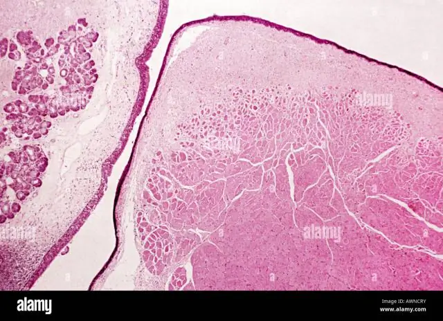 Quel type de microscope peut être utilisé pour observer des cellules et des tissus vivants ?