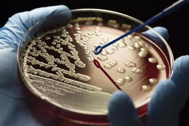 Koj yuav txheeb xyuas Gram staining bacteria li cas?