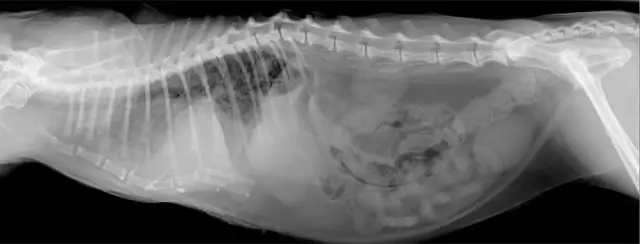 Qu'est-ce qui est laissé en radiographie?